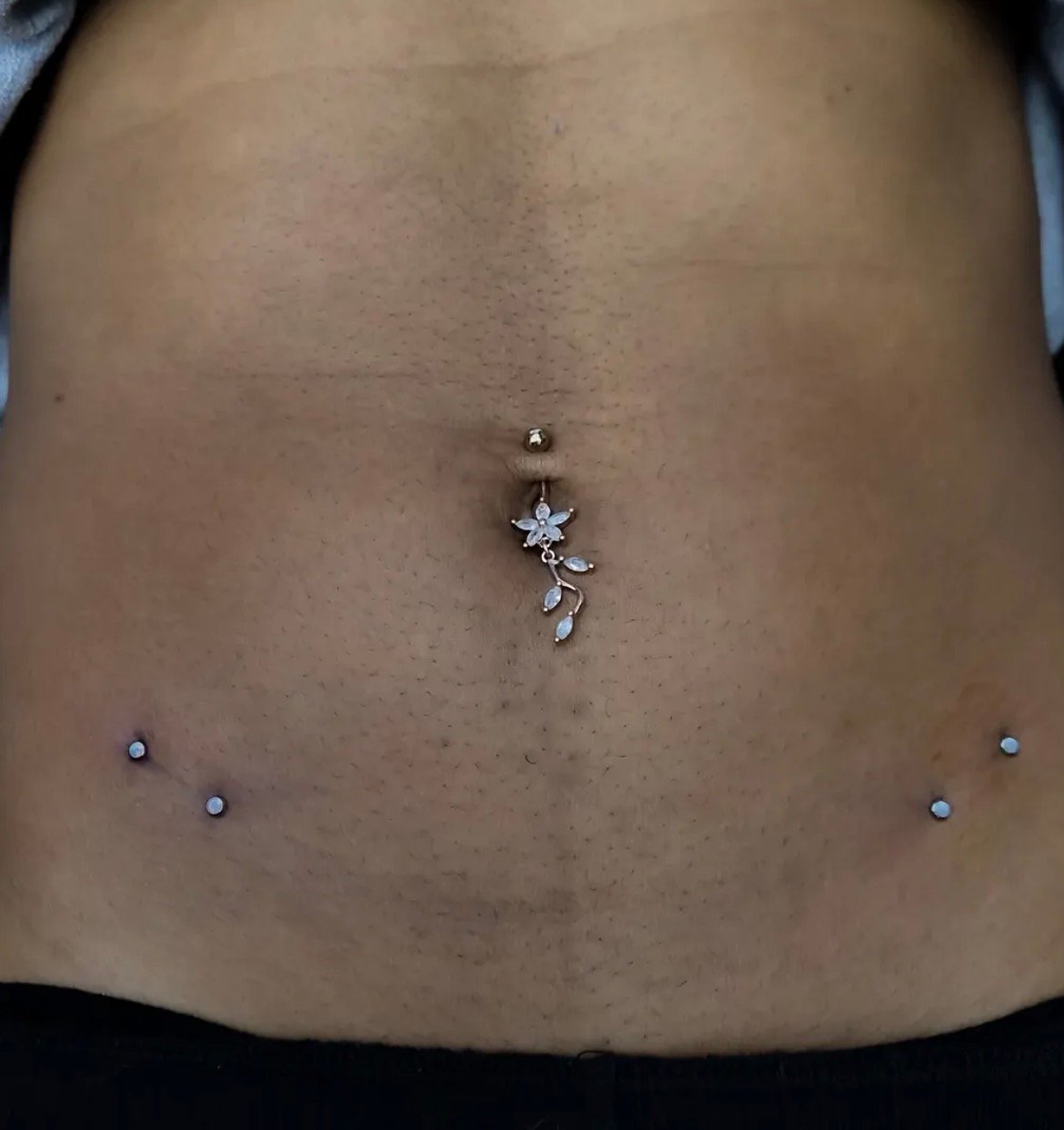 Navel piercing with decorative jewelry and lower abdominal dermals
